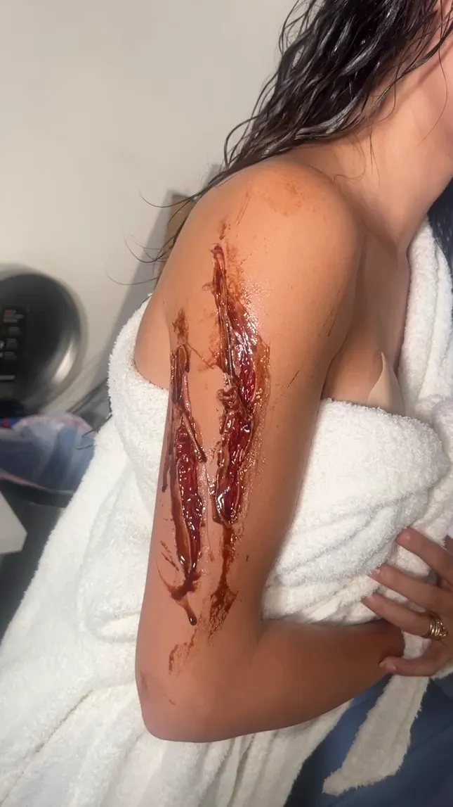 Halloween scar and blood work