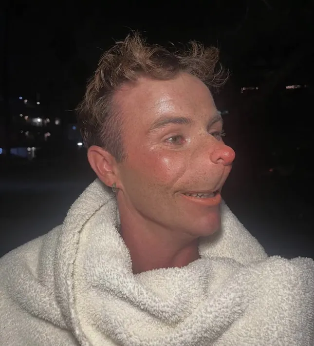 Mayor Who Nose