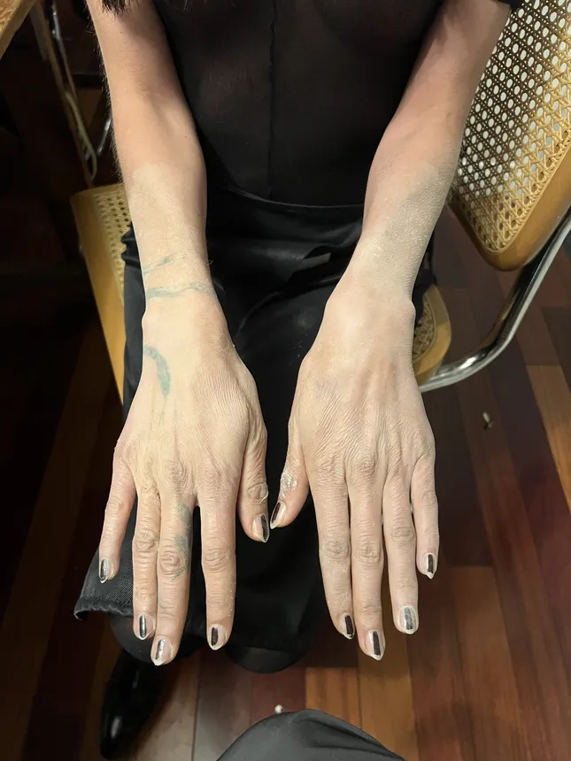 Aged hands