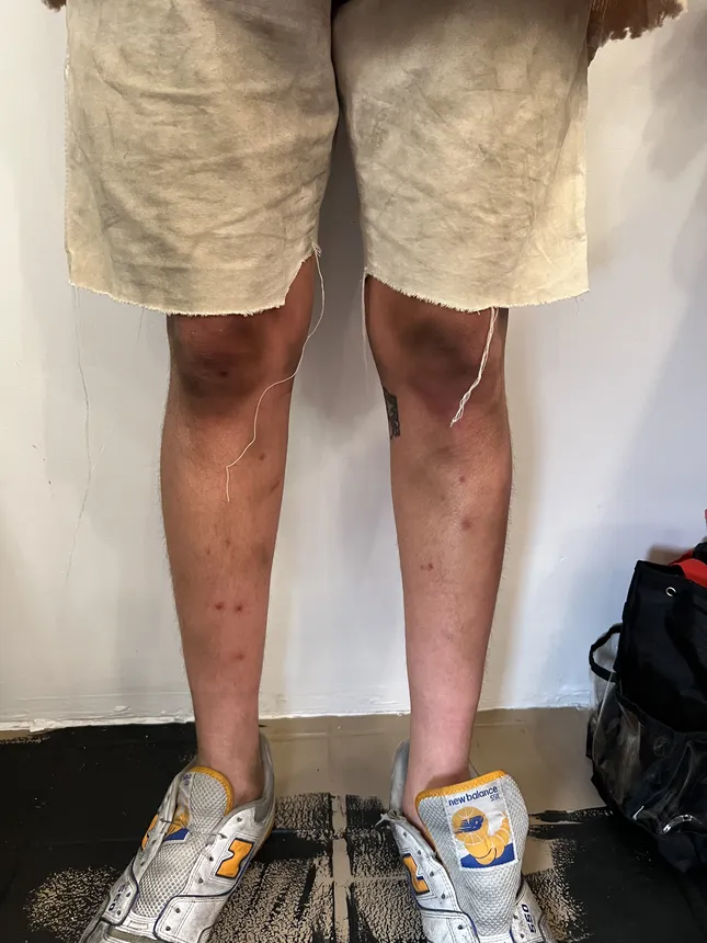 Track marks, Grime, Light Bruising