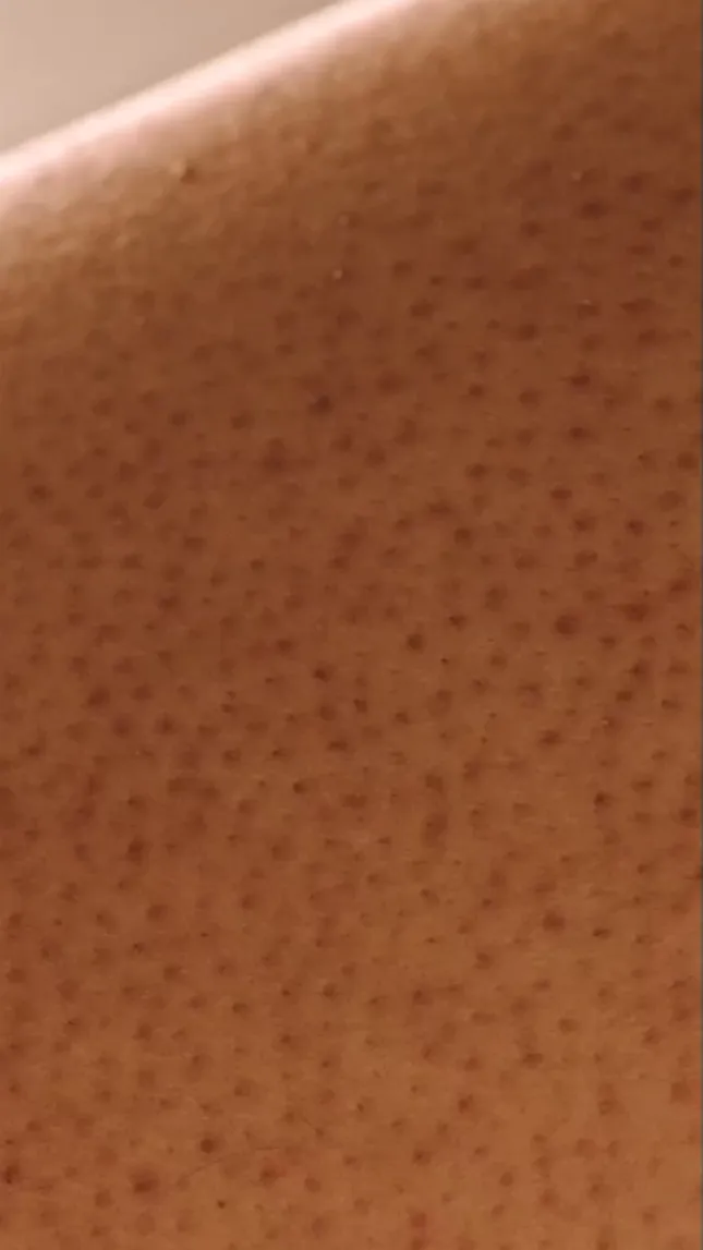 AVEENO - Social Media Ad