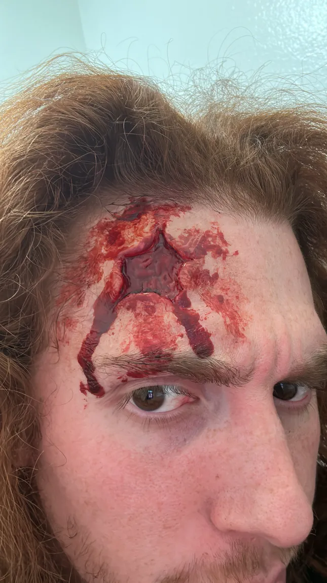 Multipurpose wound