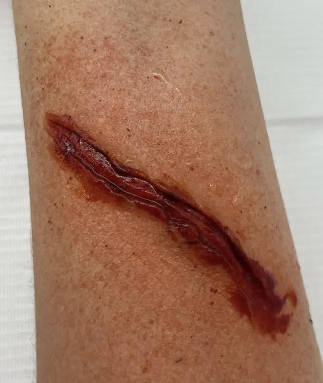 Slashed