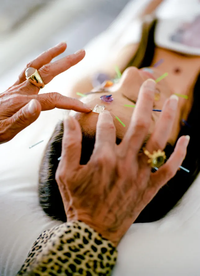 Allure Magazine: Acupuncture