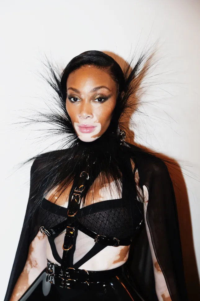 Winnie Harlow x London fashion week