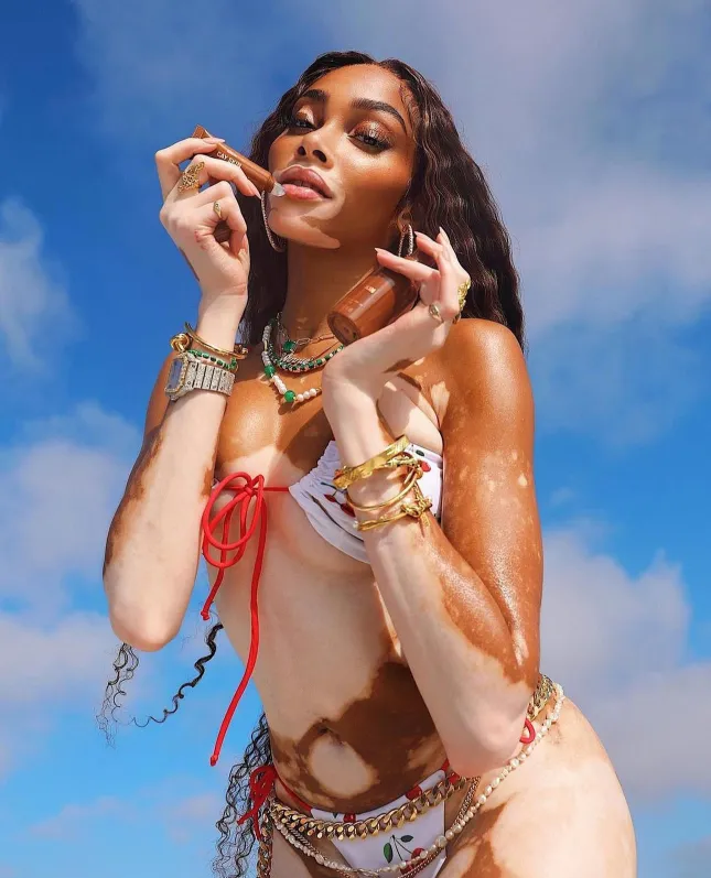 Winnie Harlow wearing Arms of Eve