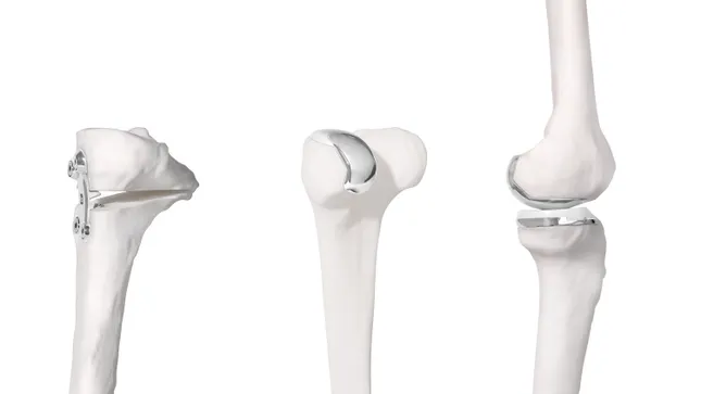 Bodycad -