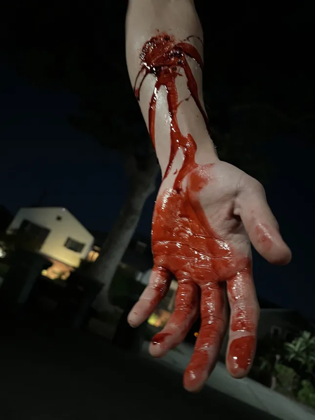 Bite me