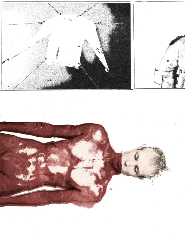Cutaneous (1)