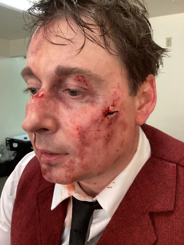 Beat up makeup SFX
