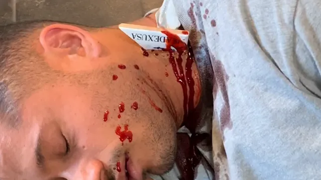 Blood FX - Adex USA & Sessemo