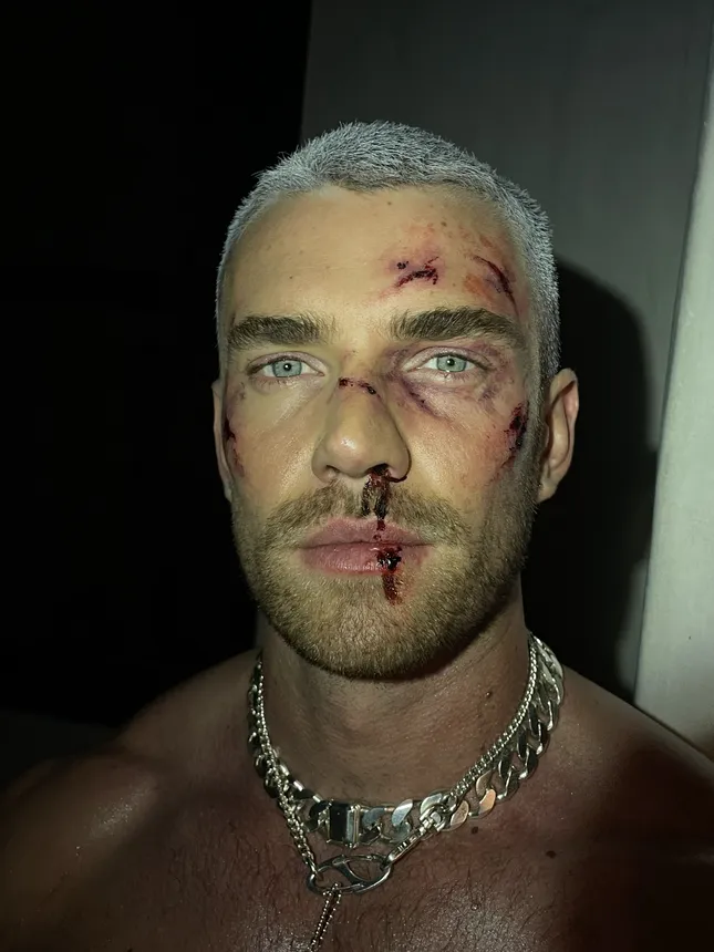 Black Eye + Bloody SFX Makeup