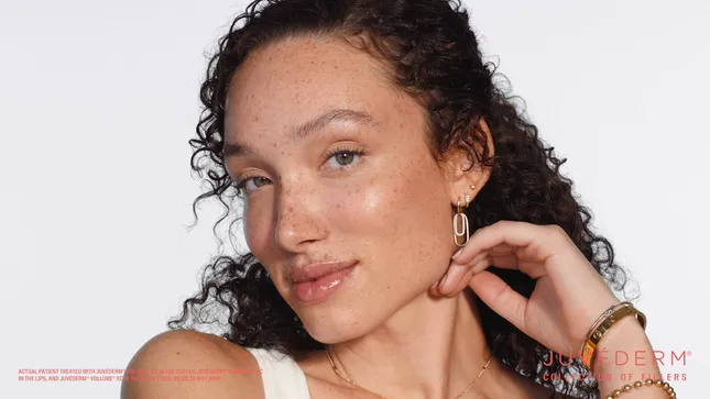 Juvéderm | Unfiltered: Ashley