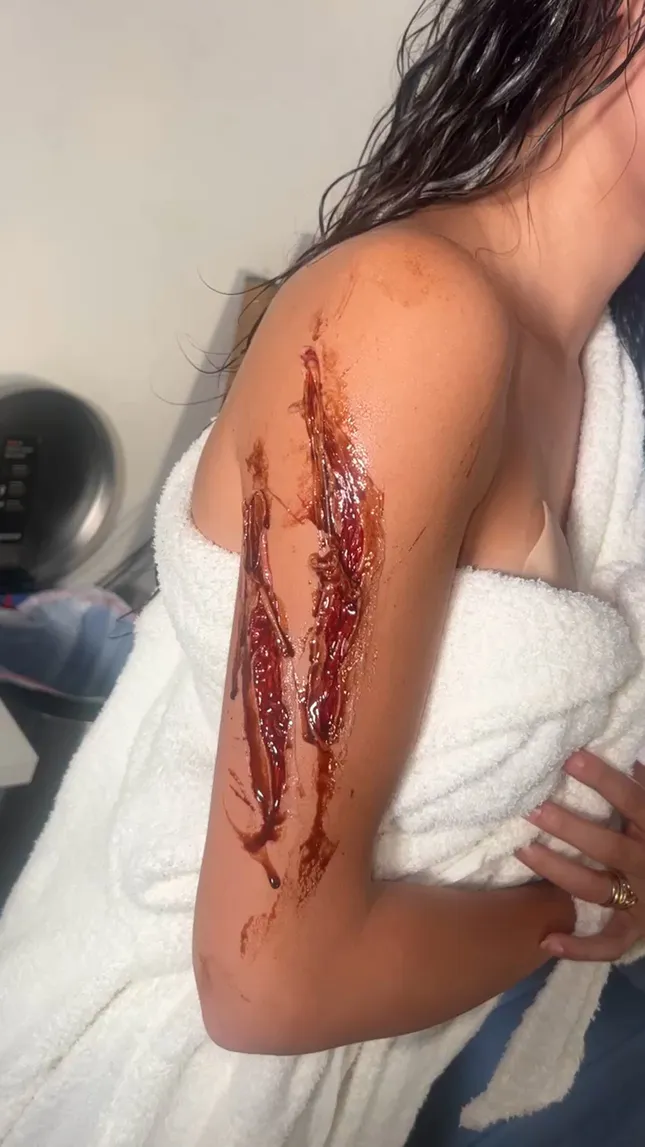 Halloween scar and blood work