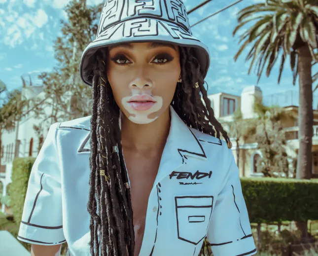 Winnie Harlow for Fendi