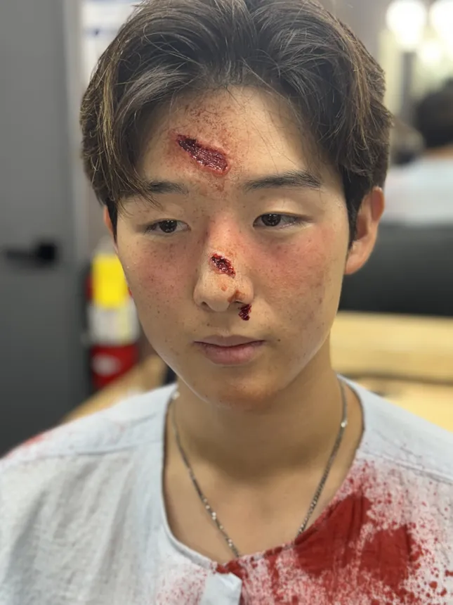 Car accident progression