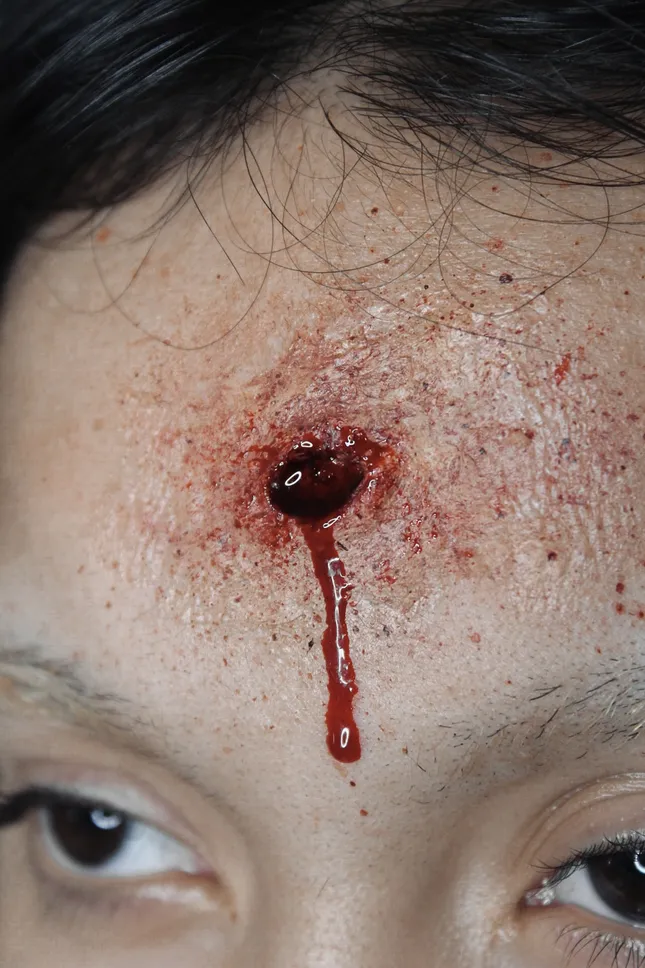 Bullet Wound (Entry) - SFX