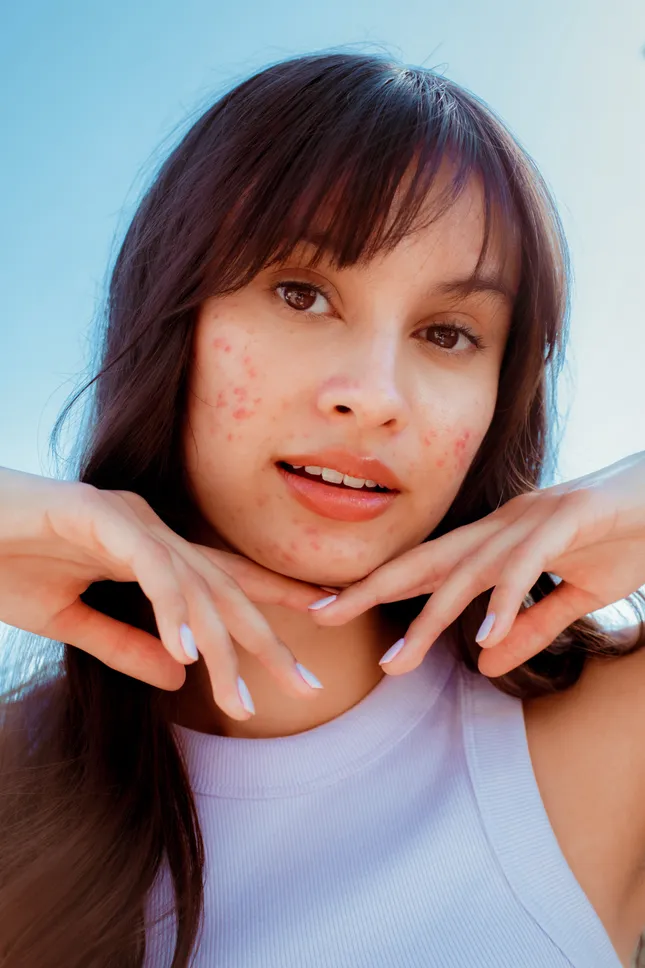 Proactiv Campaign